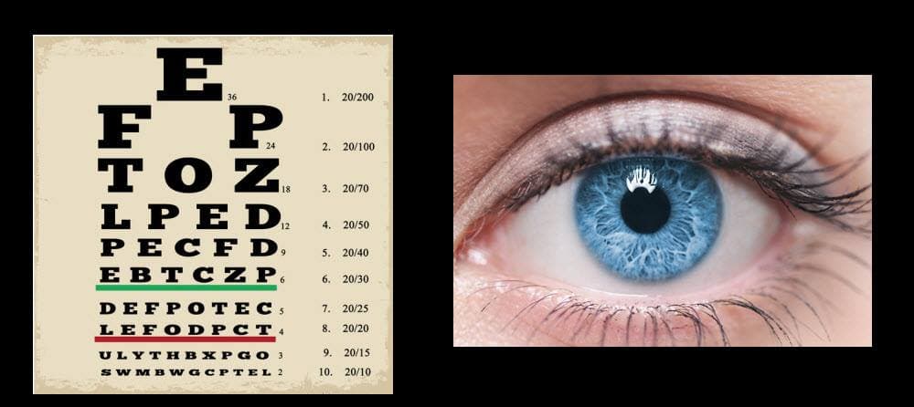 Having 20/20 vision means that you see an object at 20 feet with the clarity a “normal” eye sees it at 20 feet.