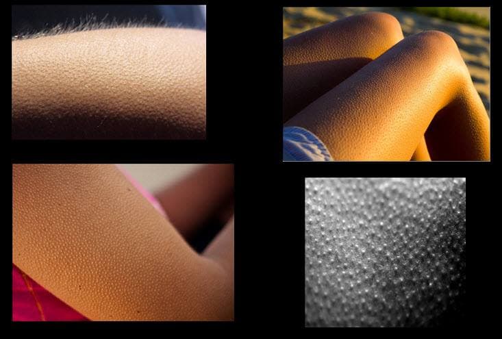 What are "Goose Bumps" and why do we get them?