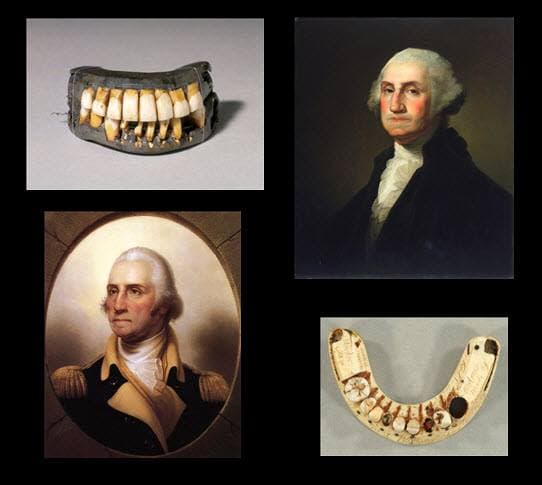 The famous claim that George Washington had wooden teeth is little more than a myth. That being said, he did indeed have some pretty extreme dental issues.