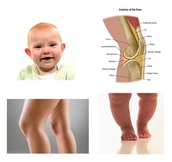 Babies are born without hard knee caps!