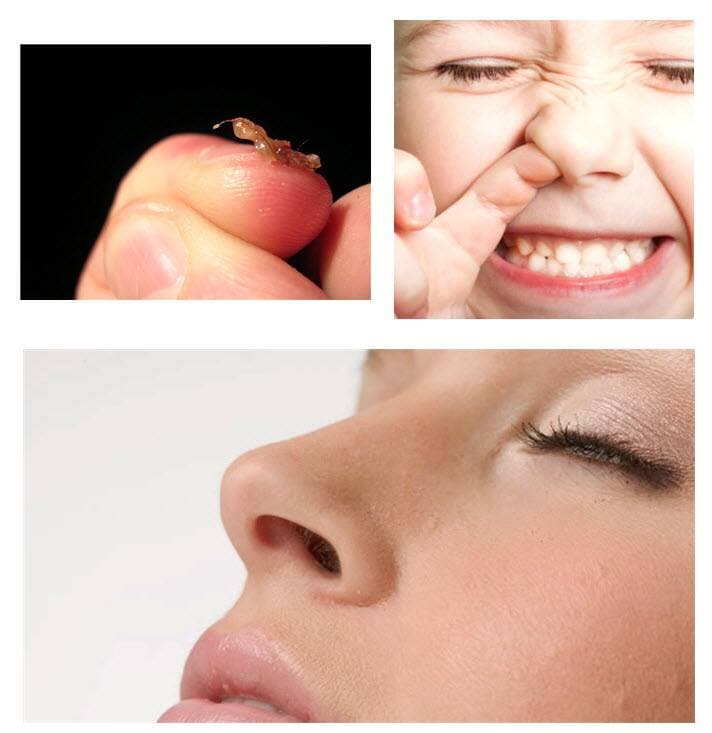 What makes up the common booger?