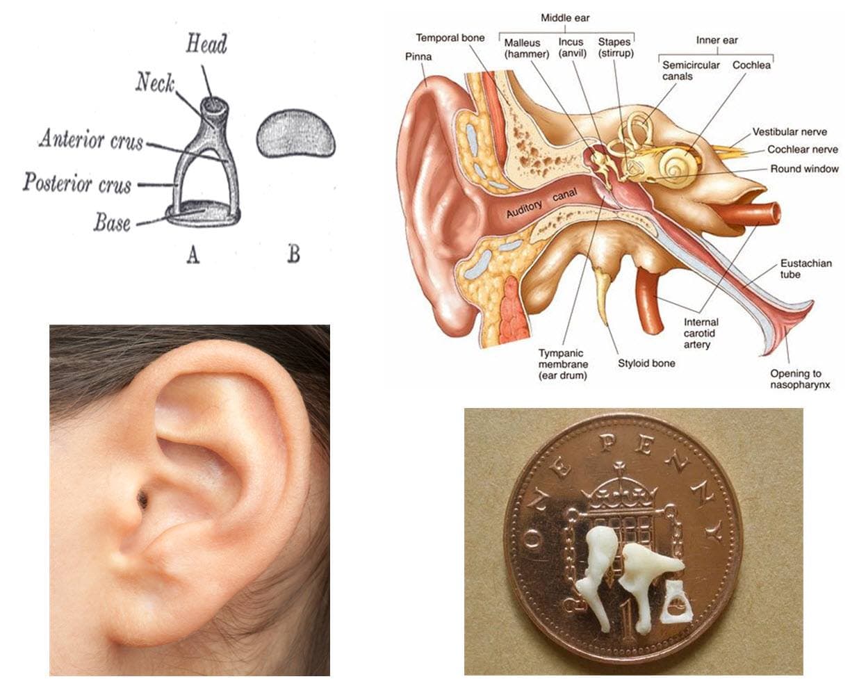 The smallest bone in the human body is the Stapes, a bone in the inner ear.